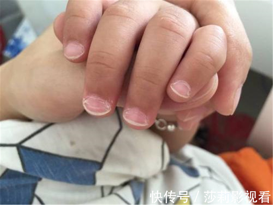 习惯|经常“啃指甲”的孩子,长大后往往逃不出这2种结局,父母要有数