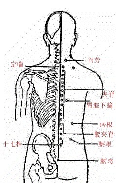 记住一个穴位治疗全身疾病建议收藏