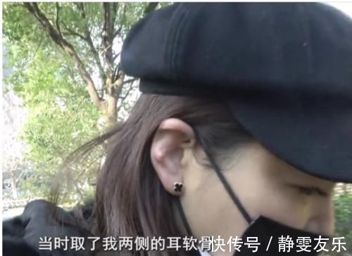 变形 隆鼻手术后耳朵变形,十多万索赔被拒,医院:没有特别失败