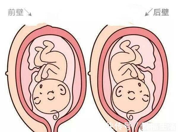 宫壁|怀孕是前壁还是后壁,里面大有学问!这4点宝妈要弄懂!