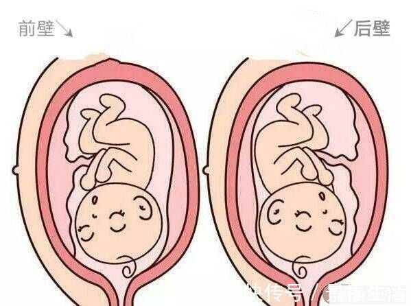宫壁|怀孕是前壁还是后壁，里面大有学问！这4点宝妈要弄懂！