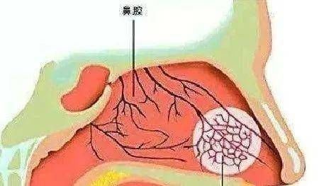 鼻粘膜|秋冬季节，鼻腔干燥怎么办？
