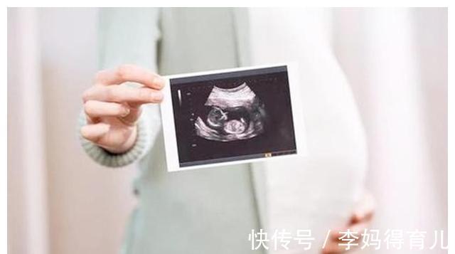 四维彩超|四维彩超不好过?医生:那是你没有提前了解注意事项