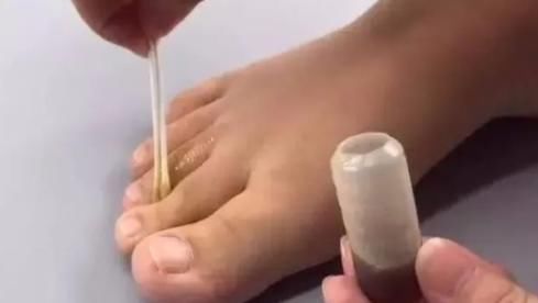 小药箱|洗完脚后，睡前把藿香正气水涂在脚底，或能帮你解决这3大烦恼