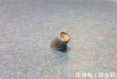 石子|头部被子弹击中,他误认为是石子,跑完52里后,却收获意外惊喜