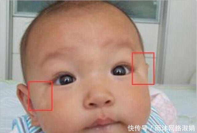 孩子|孩子出现这5种症状,要注意宝宝肚里可能长蛔虫啦