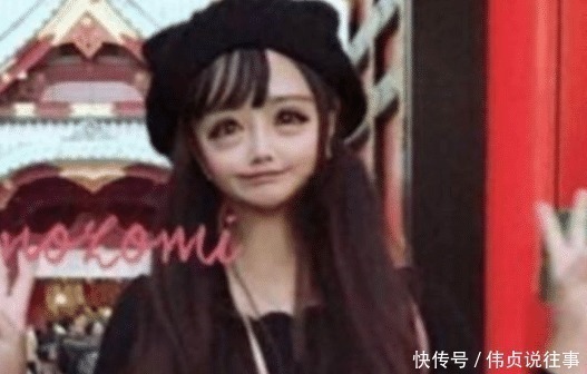 整容|日本少女疯狂整容,变成现实版的“二次元美女”,网友:青蛙脸!