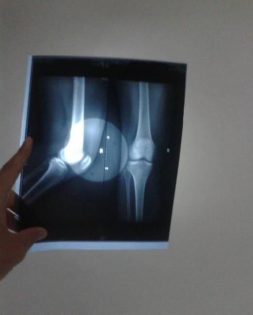 身高|孩子不长高?若能在25岁前做好3事,常吃3物,还能拔高一大截