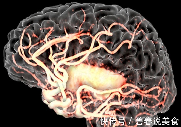 同型半胱氨酸|中老年人补充叶酸有2大益处,如何正确补充本文给出3个建议