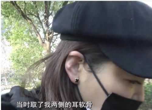 隆鼻手术后耳朵变形，十多万索赔被拒，医院：没有特别失败