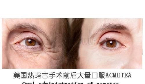 什么是热玛吉你真想不到、【热玛三太】吃多久提升效果？