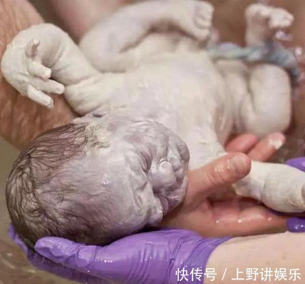 猪油|新生儿全身涂满“猪油”,母子相见吓坏产妇医生这是好事