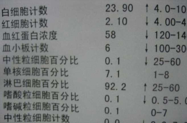 孩子|为什么越来越多孩子得白血病?医生:孩子有这5大异常,尽早就医