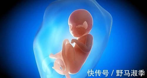 肚子|6个月脐带扭转导致胎停,是什么原因造成?以后怀孕要怎么注意?