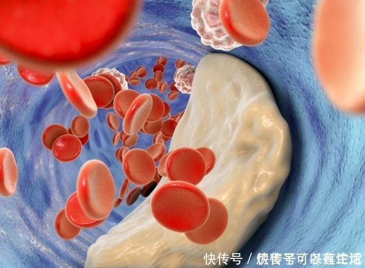 血管健康|血管的“清道夫”，不是蜂蜜，每天喝两口，冲血管，呵护血管健康