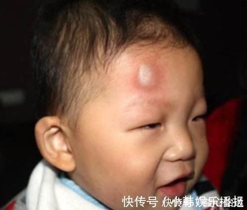 宝宝|“你是亲妈吗?”1岁宝宝摔下床,妈妈却冷眼旁观,医生:做的对