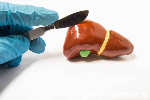 肿瘤|肝囊肿的出现，可能是肿瘤或寄生虫造成的，生活中注意避开