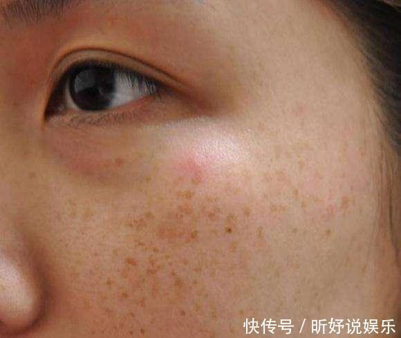 药店不值钱的它,45岁阿姨睡前抹点,皮肤满满的胶原蛋白