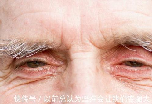 腋毛|若三个部位的“毛”旺盛,可能易长寿,如果能占一个,也值得恭喜