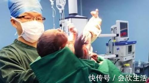 孩子|宝宝出生时直对妈妈笑,护士却反手一巴掌,得知真相宝妈连声道谢