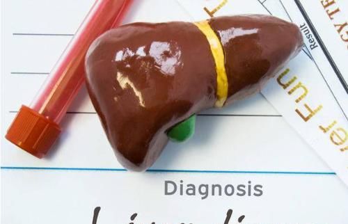  维生素|女性到了中年，3种食物离不开，补充营养、滋润肌肤