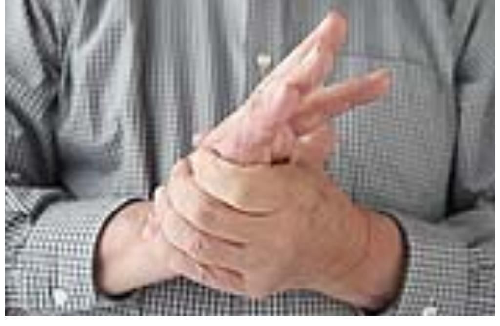 冠军|降脂“冠军”被找到,不是洋葱,你若爱吃,血管干净又通畅