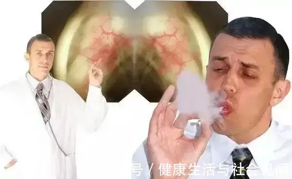 恶性肿瘤|癌症发病率为什么呈年轻化趋势?于加军:这5个行为,少碰才好