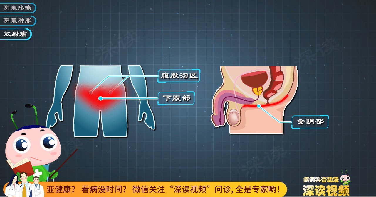 蛋蛋|蛋蛋又痛又肿还发烧？小伙长期熬夜得急性附睾炎？这些症状要小心