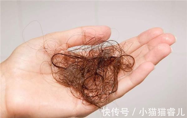 头皮|天天洗头到底好不好洗头经常犯这3个错误,怪不得头发越掉越多