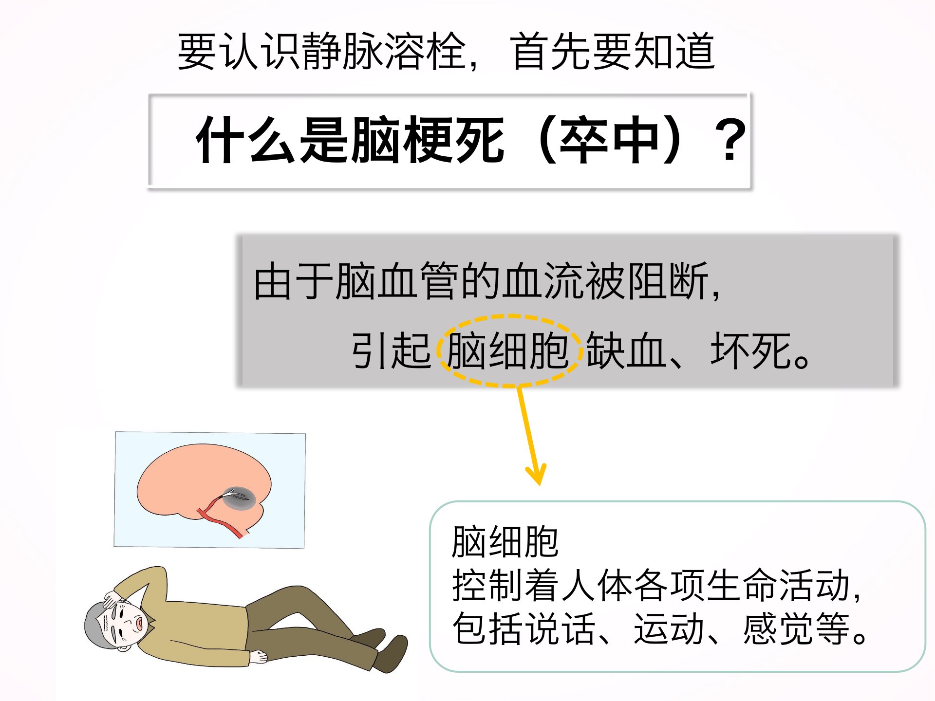 脑血管病|您为什么要选择静脉溶栓？