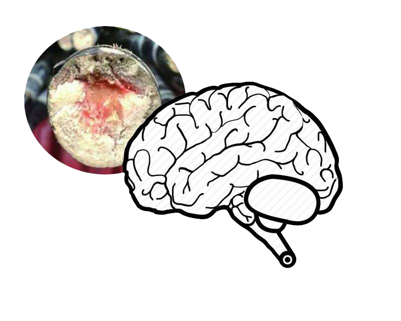 低血糖症|甘蔗的4大好处让人羡慕,但这类甘蔗可千万别吃!小心引发中毒