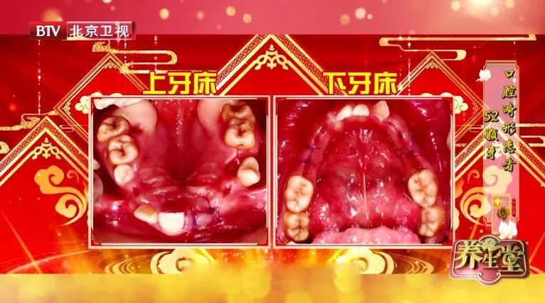 养生|8个养生误区,坑惨中老年人!小心养生不成,健康受损~不要拿生命开玩笑了!