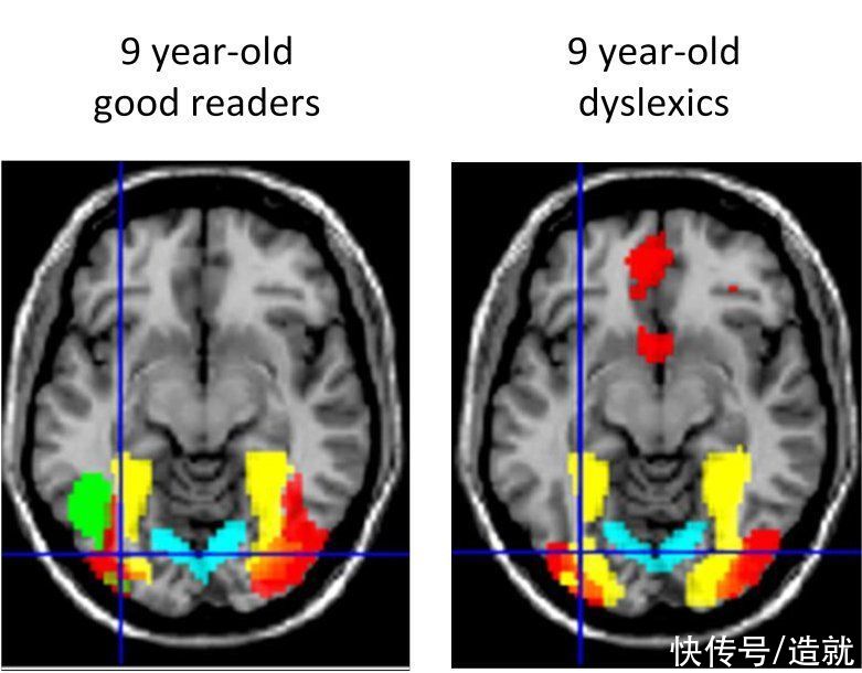 数学不好？有可能是语文没学好