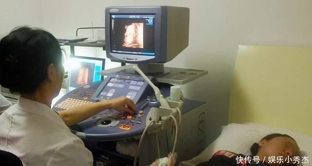 畸形儿|孕妇产检被告知是“连体畸形儿”,顿时紧张大哭,医生看了却笑了