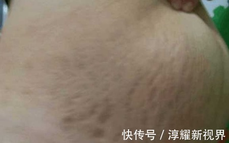 丈夫|女子第一次怀孕,产检时医生认为是二胎,得知原因后丈夫乐了