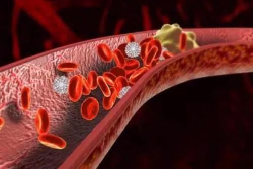 素食|血脂高的人不能吃面条?提醒:若想血脂平稳,3种素食建议少吃