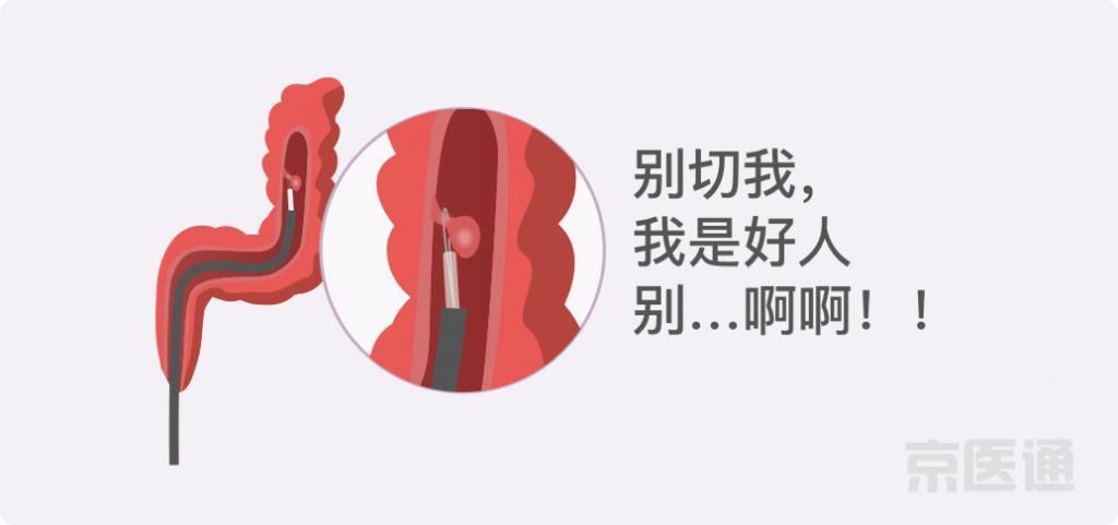 癌症|结节、息肉、囊肿是癌症先兆吗？北肿专家们说出了真相！