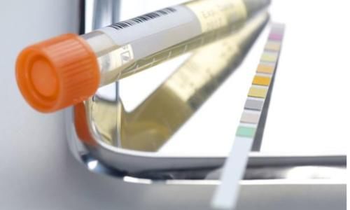 普利类|2类降压药可以降蛋白、护肾