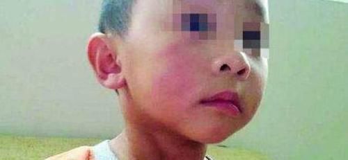 男童|“爸爸,气消了吗”,5岁男童因偷钱被打,却再也起不来了