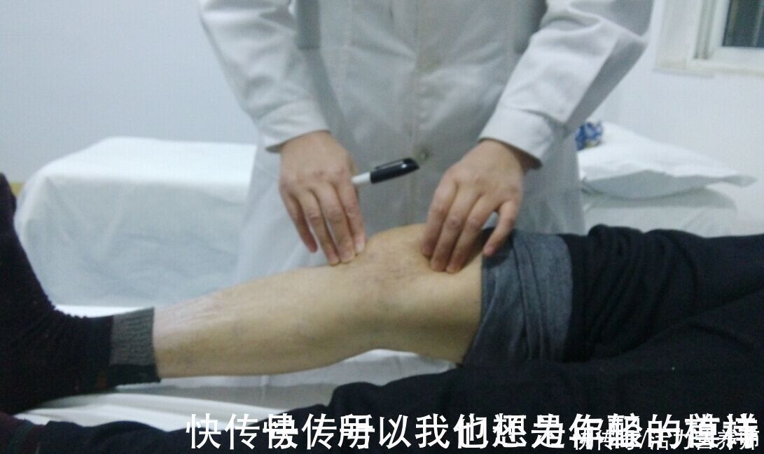 更年期综合征|50岁是女性的“多事之秋”，对于全身疼的人，4大原因帮你解惑