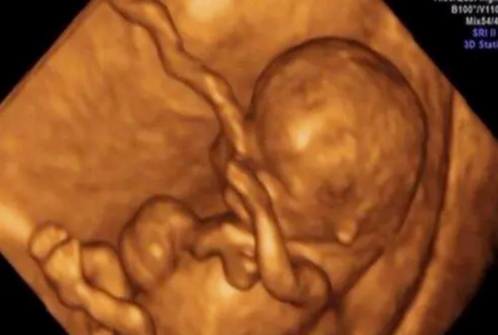 双份钱|做四维彩超后,不做这步相当于“白花钱”,在检查前孕妈要问明白