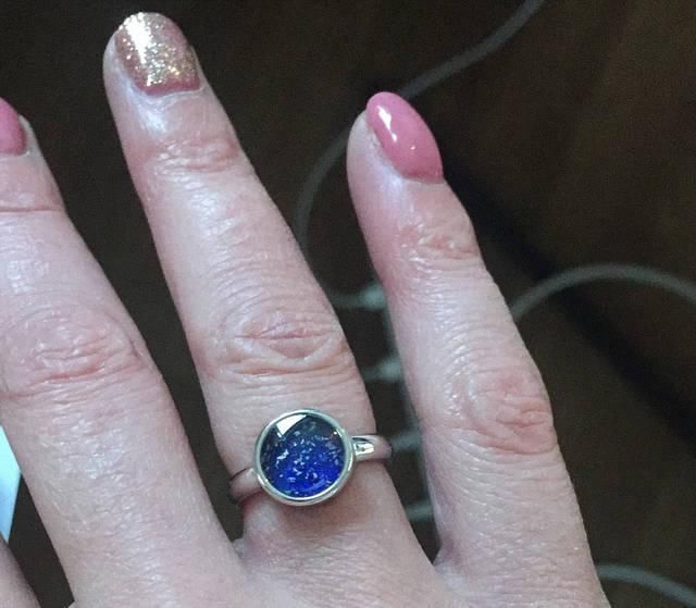 克雷格|母亲苏醒后亲吻被冰冻21天的孩子,将其做成戒指戴在手上