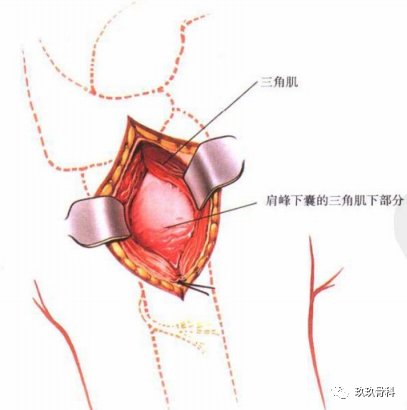 肩关节外侧入路|图文详解 | 肩关节