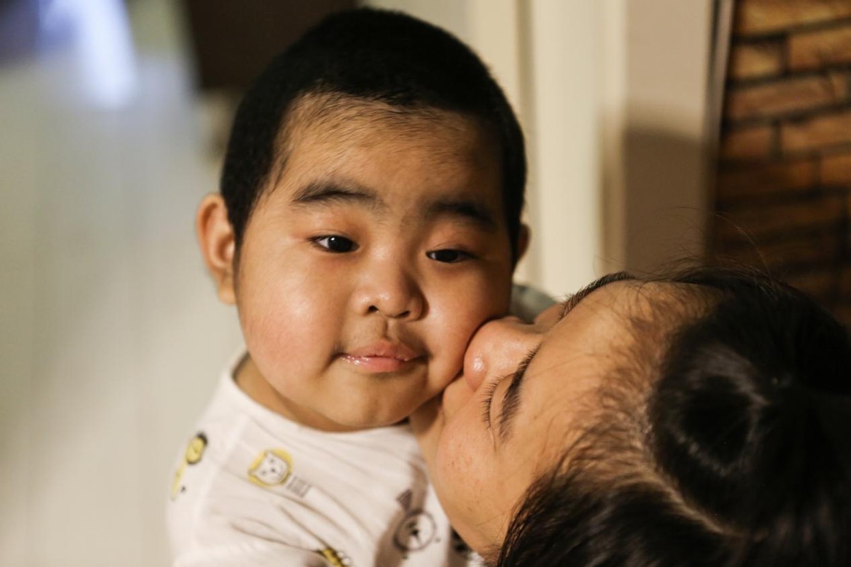 母亲|孩子患重症期间母亲发现自己怀孕,无奈忍痛做出抉择弃小保大