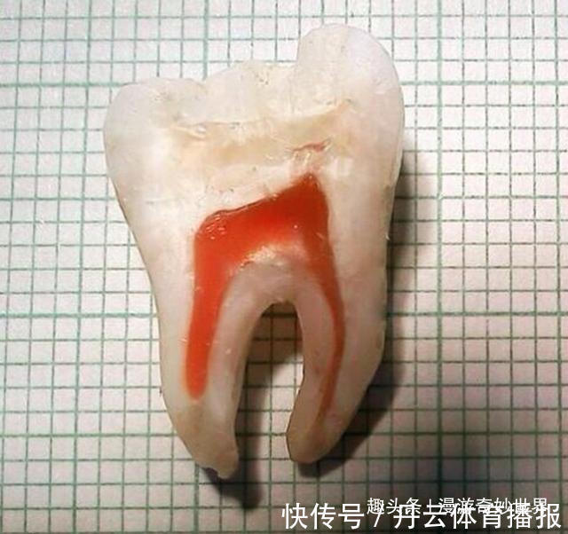 鹦鹉螺&这些东西内部长啥样?25张照片揭示日常事物看不见的一面!