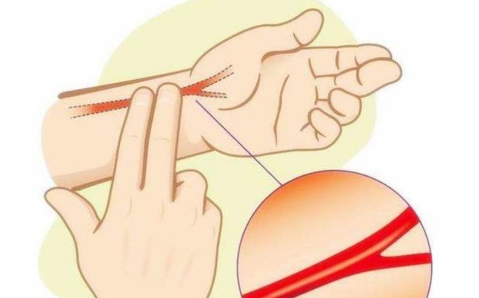 脉象的变化|把脉看怀孕是看“滑脉”，青壮年也可能有这种脉象，到底准不准？