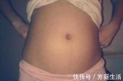 妊娠线|孕妈肚子上的黑线是什么?线在左是男在右是女?原来这么多讲究!