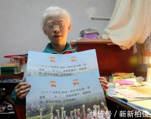 元气满满|“妈妈,我怕光”,姐妹俩出生全身雪白,网友:父母太不负责任