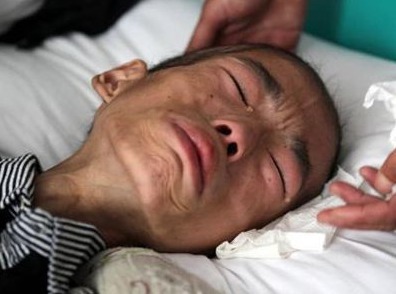 癌症患者|癌症究竟有多痛苦患癌的人,承受了生命不能承受的3种“痛”