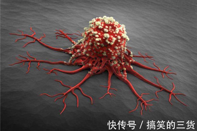 慢性疾病|经常吃“腐乳”的人,会有什么变化或许多数人不清楚,早知早好